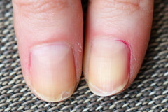 Huile ongles dédoublés, cassants à base d'HE d'Ylan-ylang, mars 2024