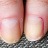 Huile ongles dédoublés, cassants à base d'HE d'Ylan-ylang, mars 2024