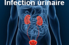L'infection urinaire, la cystite, juil. 2023